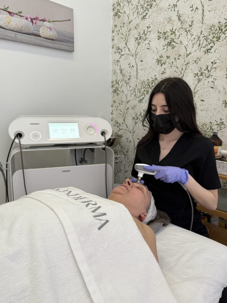 tratamiento indiba facial (3)