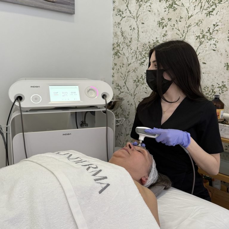 tratamiento indiba facial (2)